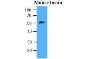 The extracts of Mouse brain (35 ug) were resolved by SDS-PAGE, transferred to PVDF membrane and probed with anti-human beta-Tubulin (1:10000).