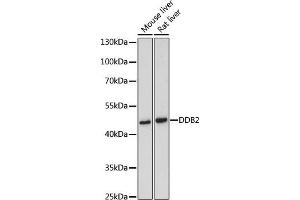 Western blot analysis of extracts of various cell lines, using DDB2 antibody (ABIN3022631, ABIN3022632, ABIN3022633 and ABIN6218976) at 1:500 dilution. (DDB2 Antikörper  (AA 1-315))