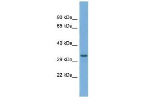 Host:  Rabbit  Target Name:  T Sample Type:  OVCAR-3 Whole Cell lysates  Antibody Dilution:  1. (TAM41 Antikörper  (C-Term))
