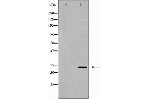 Western blot analysis of HepG2 cell lysate, using ORM1 Antibody. (ORM1 Antikörper  (Internal Region))