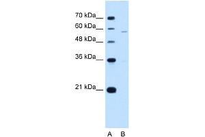 WB Suggested Anti-PIGV Antibody Titration:  5. (PIGV Antikörper  (N-Term))