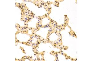Immunohistochemistry of paraffin-embedded rat lung using SRSF1 Antibody (ABIN5970815) at dilution of 1/100 (40x lens). (SRSF1 Antikörper)