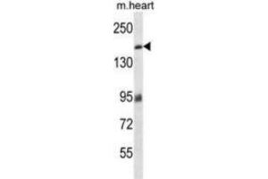 Western blot analysis in mouse heart tissue lysates (35ug/lane) using MYBPC3 Antibody (N-term). (MYBPC3 Antikörper  (N-Term))