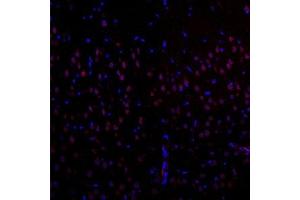 Immunofluorescence (Paraffin-embedded Sections) (IF (p)) image for anti-Eukaryotic Translation Initiation Factor 2, Subunit 2 Beta, 38kDa (EIF2S2) antibody (ABIN7073880)