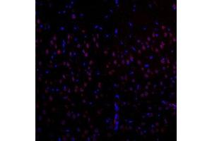 Immunofluorescent analysis of paraffin-embedded rat brain using EIF2S2 (ABIN7073880) at dilution of 1: 1000 (EIF2S2 Antikörper)