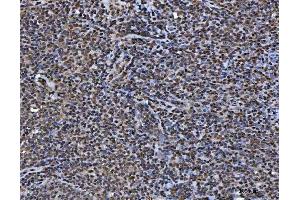 IHC analysis of TIP49A/RUVBL1 using anti-TIP49A/RUVBL1 antibody (ABIN7599928). (RUVBL1 Antikörper  (AA 13-23))