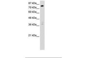 Image no. 1 for anti-TSC22 Domain Family, Member 2 (TSC22D2) (C-Term) antibody (ABIN6736248) (TSC22D2 Antikörper  (C-Term))