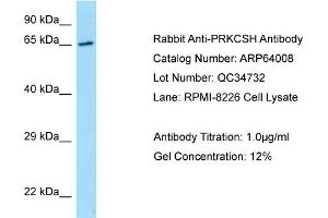 Western Blotting (WB) image for anti-Protein Kinase C Substrate 80K-H (PRKCSH) (N-Term) antibody (ABIN2789692) (PRKCSH Antikörper  (N-Term))