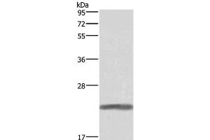 Western Blot analysis of Human placenta tissue using GH1 Polyclonal Antibody at dilution of 1:500 (Growth Hormone 1 Antikörper)