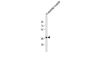 Western Blot at 1:2000 dilution + human skeletal muscle lysate Lysates/proteins at 20 ug per lane. (TRIB1 Antikörper  (C-Term))