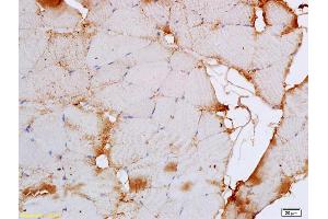 Immunohistochemistry (IHC) image for anti-Calcium Channel, Voltage-Dependent, L Type, alpha 1S Subunit (CACNA1S) (AA 951-1001) antibody (ABIN1387901)
