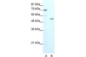 WB Suggested Anti-ZNF665 Antibody Titration:  1. (ZNF665 Antikörper  (N-Term))