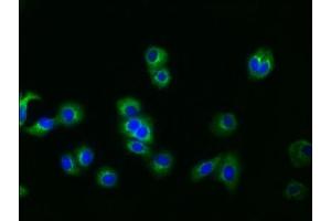 Immunofluorescence staining of HepG2 cells with ABIN7127519 at 1:30, counter-stained with DAPI. (Rekombinanter Glypican 3 Antikörper)
