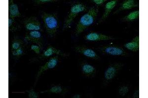 Immunofluorescence (Cultured Cells) (IF (cc)) image for anti-Antigen Identified By Monoclonal Antibody Ki-67 (MKI67) (AA 1201-1300) antibody (ABIN677858)