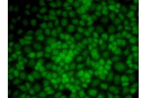 Immunofluorescence analysis of HeLa cells using UMPS antibody (ABIN5973202).
