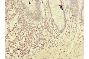Immunohistochemistry of paraffin-embedded human colon tissue using ABIN7158359 at dilution of 1:100 (LMO3 Antikörper  (AA 1-145))