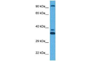 Host:  Rabbit  Target Name:  ZFX  Sample Tissue:  Human HT1080 Whole Cell  Antibody Dilution:  1ug/ml (ZFX Antikörper  (N-Term))