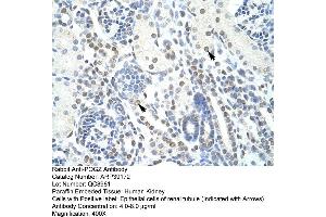 Human kidney (POGZ Antikörper  (N-Term))