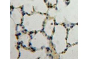 IHC-P analysis of Lung tissue, with DAB staining. (NUP88 Antikörper  (AA 476-713))