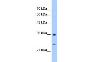 WB Suggested Anti-GSTZ1 Antibody Titration:  2. (GSTZ1 Antikörper  (N-Term))