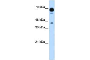 Western Blotting (WB) image for anti-Pseudouridylate Synthase 7 Homolog (PUS7) antibody (ABIN2462966) (PUS7 Antikörper)