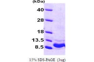 SDS-PAGE (SDS) image for Chemokine (C-X-C Motif) Ligand 1 (Melanoma Growth Stimulating Activity, Alpha) (CXCL1) (AA 35-107) protein (His tag) (ABIN666722)