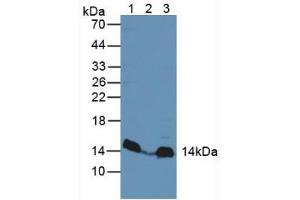 Western blot analysis of (1) Rat Heart Tissue, (2) Human Liver Tissue and (3) Mouse Liver Tissue.