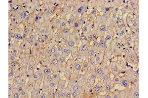 Immunohistochemistry of paraffin-embedded human liver tissue using ABIN7171513 at dilution of 1:100 (TOM1 Antikörper  (AA 306-487))