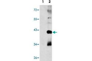 Western blot analysis of MAPK11 (arrow) using MAPK11 polyclonal antibody . (MAPK11 Antikörper  (Internal Region))