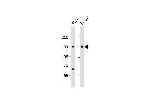 All lanes : Anti-MTUS1 Antibody (C-Term) at 1:2000 dilution Lane 1: Hela whole cell lysate Lane 2: Jurkat whole cell lysate Lysates/proteins at 20 μg per lane. (MTUS1 Antikörper  (AA 983-1017))