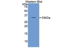 Detection of Recombinant PLA2R1, Human using Polyclonal Antibody to Phospholipase A2 Receptor 1 (PLA2R1) (PLA2R1 Antikörper  (AA 385-643))