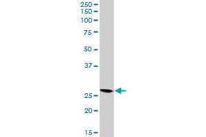 VAPB MaxPab rabbit polyclonal antibody. (VAPB Antikörper  (AA 1-243))