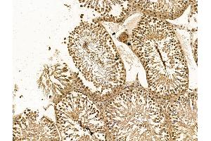 ABIN7094433 and ABIN7098481 at 1/100 staining Rat testis tissue by IHC-P.