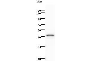 Western Blotting (WB) image for anti-Non-SMC Condensin I Complex, Subunit H (NCAPH) antibody (ABIN931216) (NCAPH Antikörper)