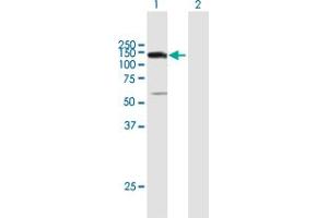 Western Blot analysis of UTP14A expression in transfected 293T cell line by UTP14A MaxPab polyclonal antibody. (UTP14A Antikörper  (AA 1-771))