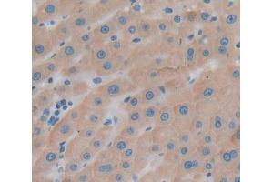 IHC-P analysis of Kidney tissue, with DAB staining. (UBAP1 Antikörper  (AA 1-295))