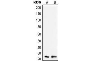 Western blot analysis of SCC-S2 expression in K562 (A), Raw264.