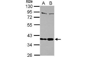 WB Image Sample (30 ug of whole cell lysate) A: Jurkat B: Raji 10% SDS PAGE antibody diluted at 1:1000 (Selenoprotein P Antikörper)
