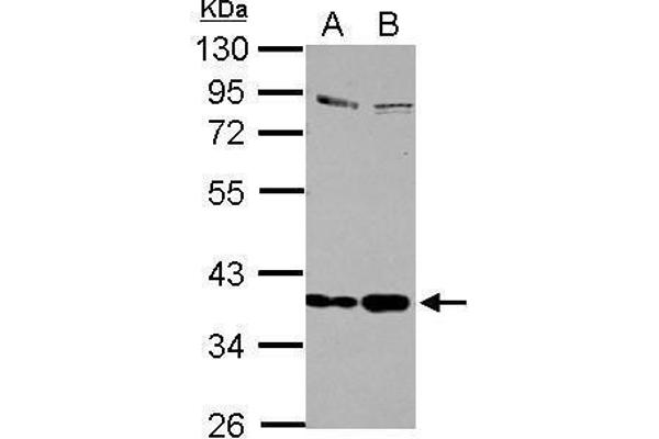 Selenoprotein P anticorps