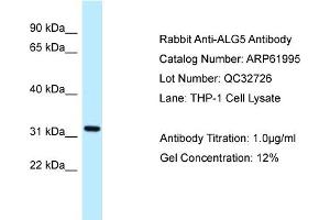 Western Blotting (WB) image for anti-Asparagine-Linked Glycosylation 5, Dolichyl-Phosphate beta-Glucosyltransferase Homolog (S. Cerevisiae) (ALG5) (N-Term) antibody (ABIN2788980) (ALG5 Antikörper  (N-Term))