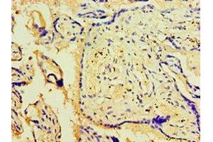 Immunohistochemistry of paraffin-embedded human placenta tissue using ABIN7175707 at dilution of 1:100
