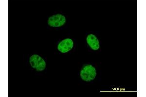 Immunofluorescence of purified MaxPab antibody to KBTBD9 on HeLa cell. (KLHL29 Antikörper  (AA 1-503))