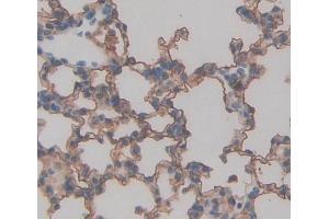 Immunohistochemistry (IHC) image for anti-Transporter 2, ATP-Binding Cassette, Sub-Family B (MDR/TAP) (TAP2) (AA 467-703) antibody (ABIN5013137)