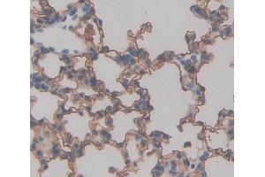 Used in DAB staining on fromalin fixed paraffin- embedded lung tissue (TAP2 Antikörper  (AA 467-703))