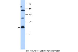Western Blotting (WB) image for anti-Suppressor of Cytokine Signaling 1 (SOCS1) (N-Term) antibody (ABIN2777164)