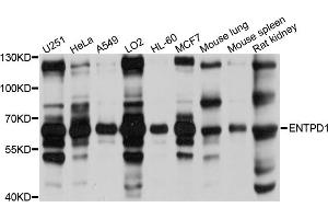 Western blot analysis of extracts of various cell lines, using ENTPD1 antibody (ABIN5971962) at 1/1000 dilution. (CD39 Antikörper)
