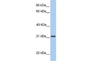 SRPRB antibody used at 1 ug/ml to detect target protein. (SRPRB Antikörper  (Middle Region))