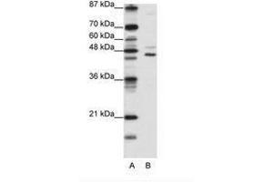 Image no. 1 for anti-Jumonji Domain Containing 4 (JMJD4) (C-Term) antibody (ABIN6736176) (JMJD4 Antikörper  (C-Term))