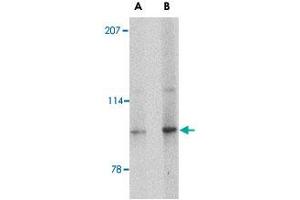 Western blot analysis of SLITRK4 in mouse brain tissue lysate with SLITRK4 polyclonal antibody  at (A) 0. (SLITRK4 Antikörper  (C-Term))