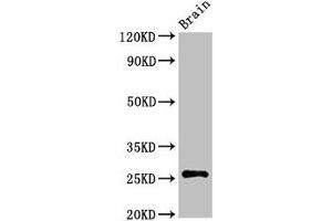 Western Blot Positive WB detected in: Rat brain tissue All lanes: ASCL1 antibody at 3 μg/mL Secondary Goat polyclonal to rabbit IgG at 1/50000 dilution Predicted band size: 26 kDa Observed band size: 26 kDa (ASCL1 Antikörper  (AA 1-236))